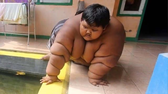 13岁男孩饭量普通四个人吃的那么多，体重400斤，父母还这样