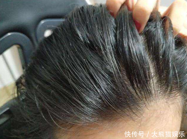  『老师』才洗完头，隔天就出油Tony老师这3点没做对，难怪油腻还痒