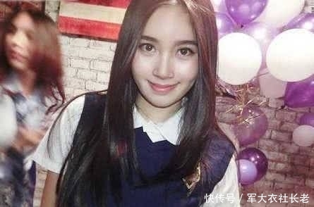  「经历」继金星后又一男星改变自己 术后恢复过程苦不堪言 如今美过杨颖