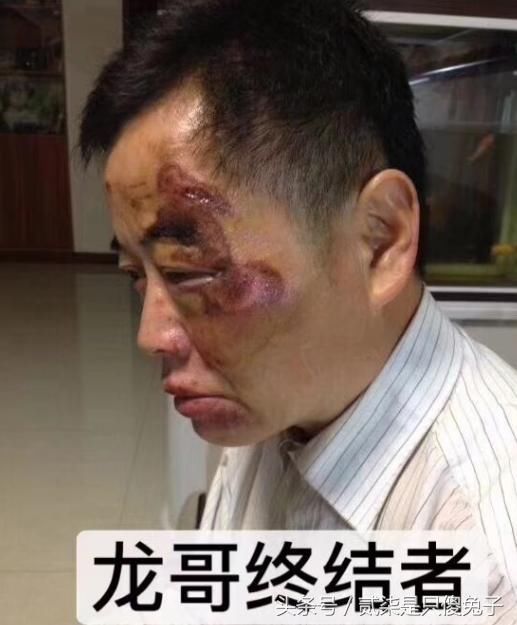 宝马男被反杀案:其实认定正当防卫并不难