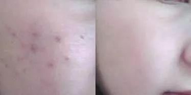 为什么白的女生总是比较受欢迎？