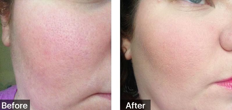 佟大为关悦“老夫老妻”霸屏综艺,演技开挂甜腻如初恋!