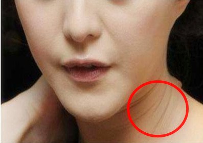 105岁姥姥说,药店放角落的药膏,早晚一抹,斑点、皱纹全消失