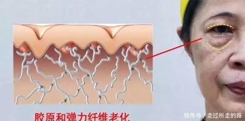马蹄莲藕@眼袋太大,颜值被拉低!只需这样做,和眼袋说“拜拜”