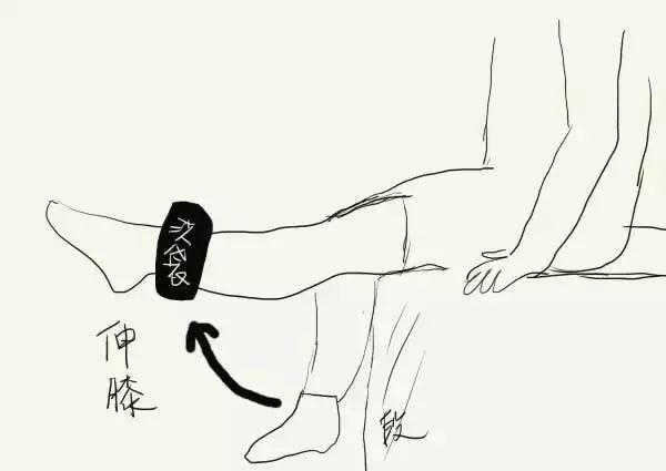  『术后』扁平足需要做手术吗？术后多久才可以恢复？