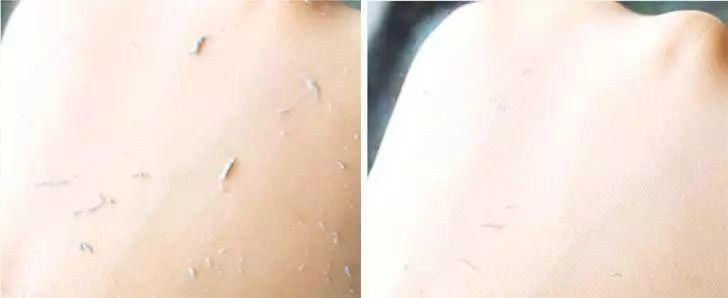 张韶涵又双叒叕种草了!10秒洗出角质、死皮，温和去角质...