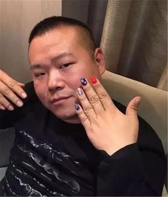  #美甲#将蚊子封印在美甲里！这种操作太独特，有点不敢伸手的样子