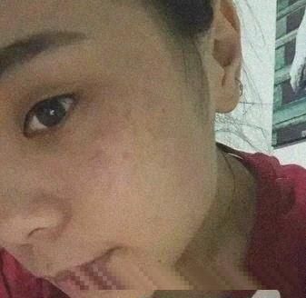 脸上长了“老年斑”不用着急，试试这个小方法，斑不见了脸还白了