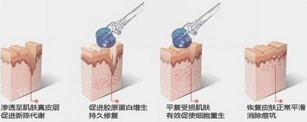 章泽天素颜又双叒叕上热搜了，这买了包月热搜服务吗？这颜值服气