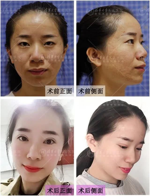  「时代」让眼睛定格美丽，告别“妆修”时代