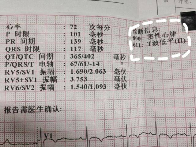窦性心律 信息图文欣赏 信息村 K0w0m Com