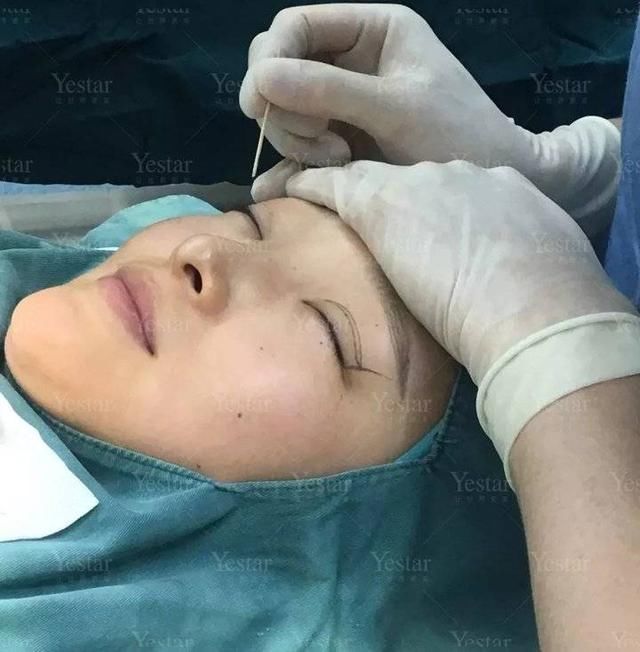  济南@想做双眼皮？先了解这8大误区！济南艺星第五季美杜莎女郎征集中