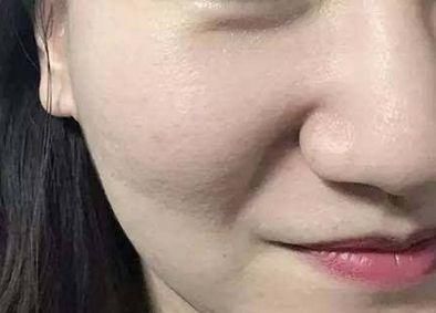 baby妆前皮肤暗嘴歪，妆后美如瓷娃娃?网友:整容般的妆法~