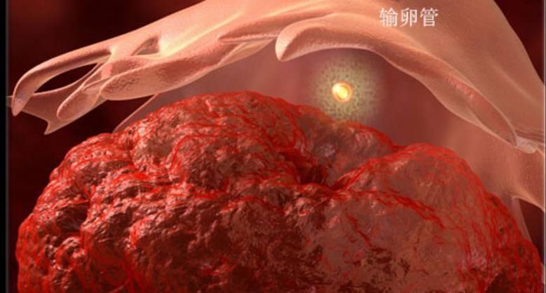  『着床成功』原来出现这些症状，说明“受精卵”着床了，孕妈要做好养胎准备