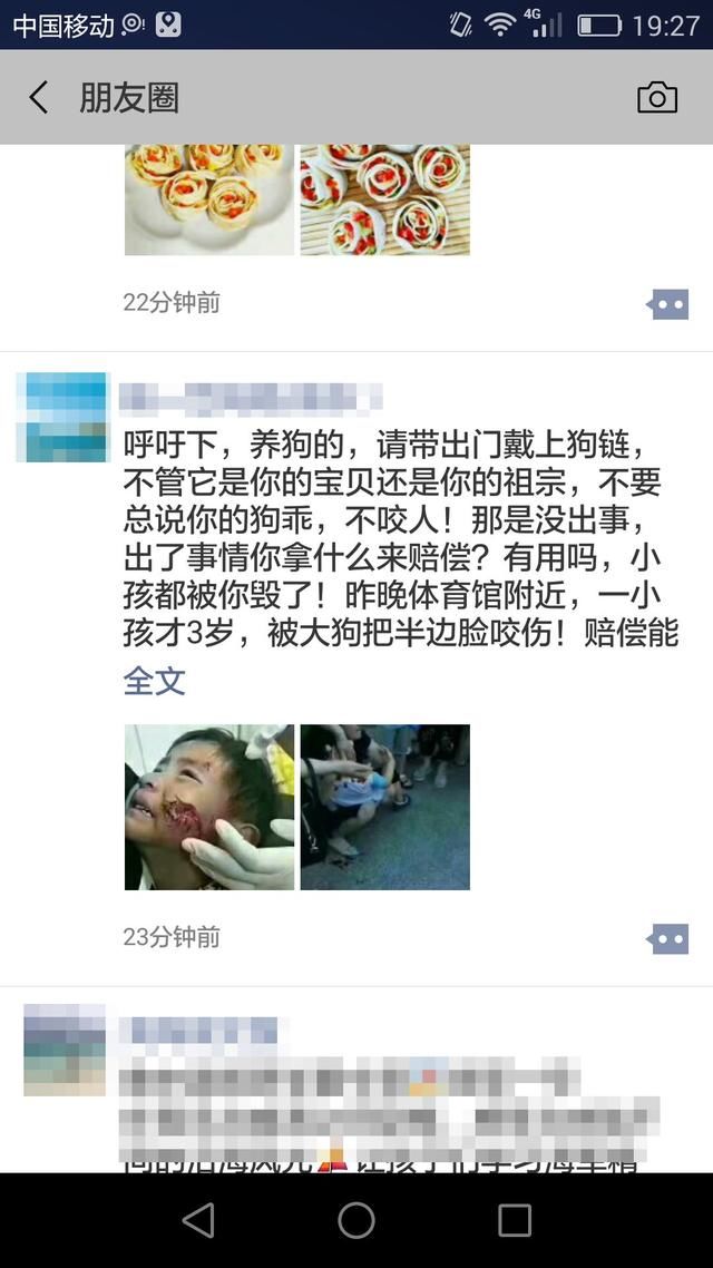 FM889小孩被狗咬伤半边脸？疯传滨州人朋友圈！真相是这样的！