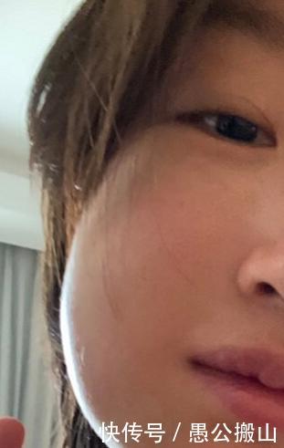 周冬雨拔智齿几颗