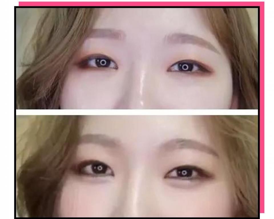 “你这个是肿眼泡，哭不出邓伦那样的双眼皮的。”