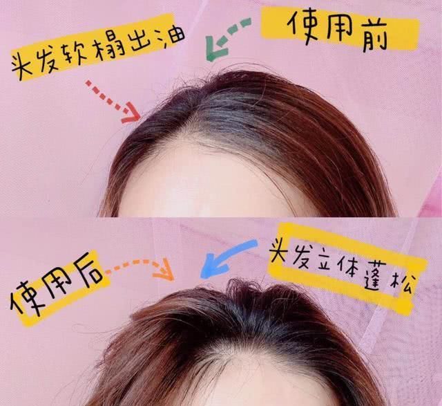  细软@轻松拯救你的发量，让你从此告别“细软塌”，赶紧get起来吧