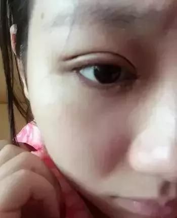 双眼皮+开眼角=我魅力大眼！