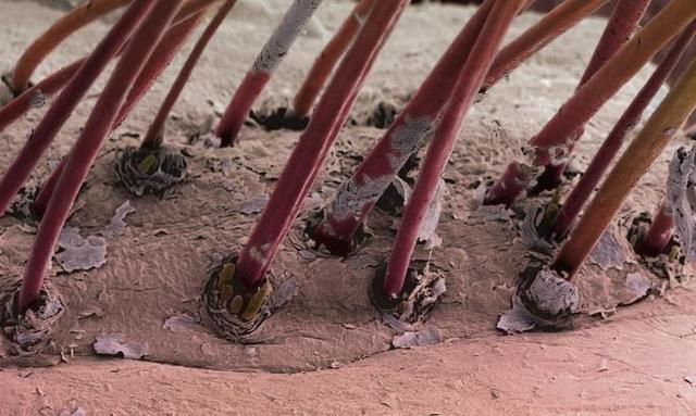 3种表现证明你脸上长螨虫，很多女生用错醋洗脸，难怪没效果