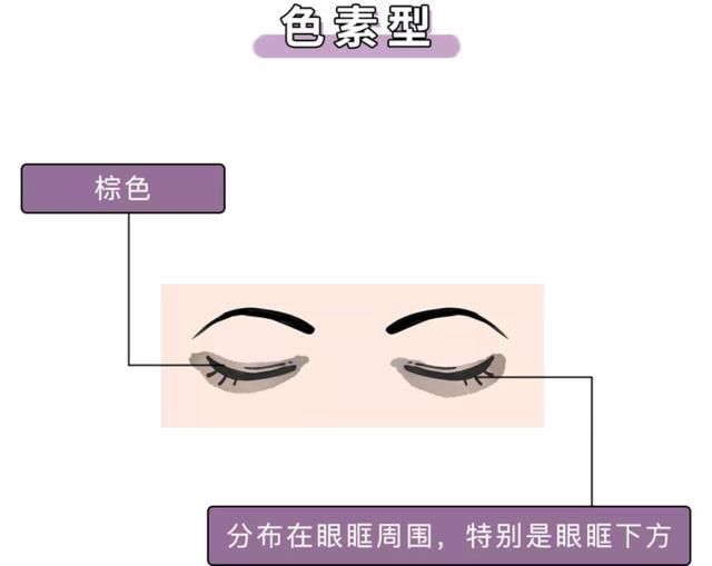  『刷屏』问壹点｜“本人黑眼圈证明”刷屏？壹起扒一扒黑眼圈的前世今生
