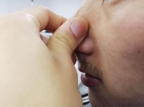  『油脂』鼻子上挤出“白色条状物”？学会这3招，趁早和“草莓鼻”说拜拜