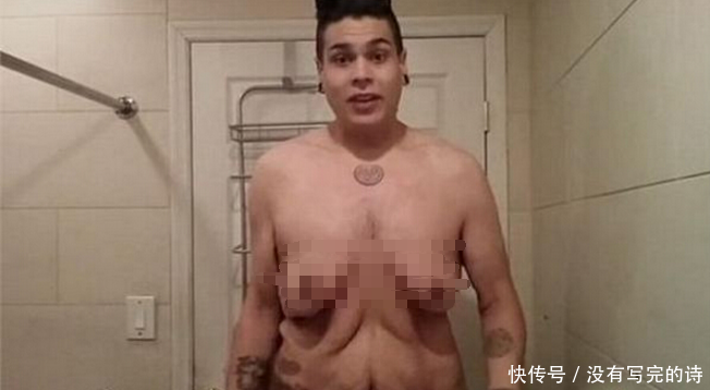 300斤小伙拼命减肥终于成功，而随后发生的事却让他更加烦恼