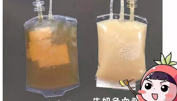 吃小龙虾吃出“牛奶血”，是谣言还是事实？