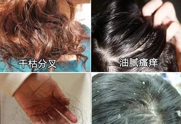  [列入]这3种洗发水被列入“黑名单”你是不是还在用,难怪发质差
