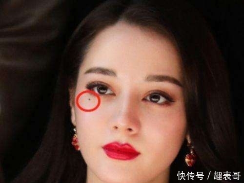 # 变丑#心里偷偷乐吧,点掉反而变丑,脸上这些地方有“痣”的女生