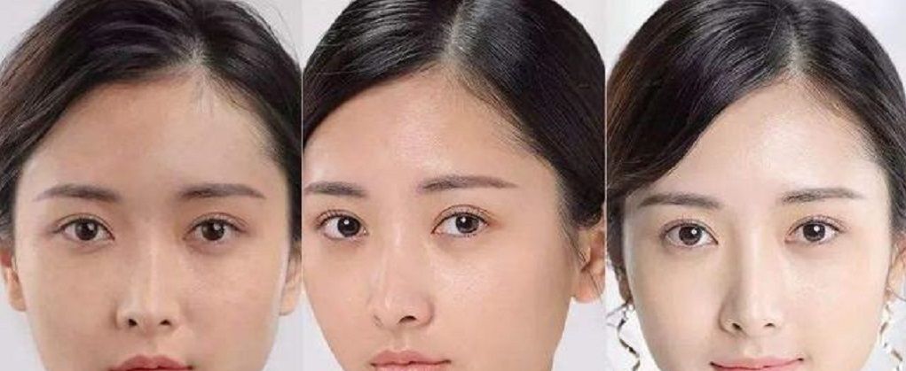  『方法』听说用香菜煮的水洗脸可以祛脸上的雀斑,是真的吗?