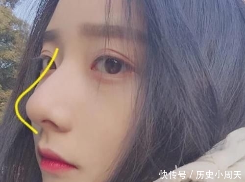 『鸡蛋』鼻子上挤出“白色条状物”?学会这3招,或与“草莓鼻”说拜拜呦!