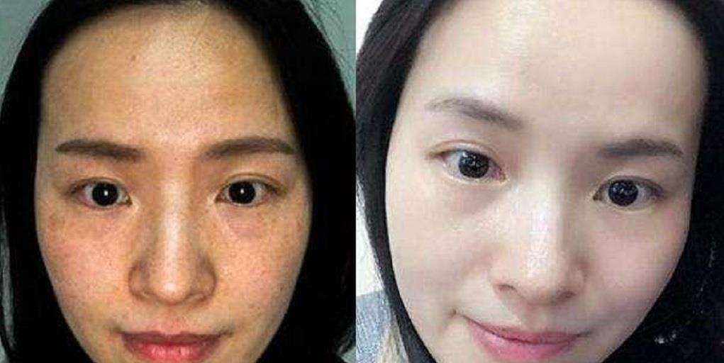  『皮肤』马齿苋加它敷脸，美白祛斑太惊人了，跑美容院的钱都省了不少！