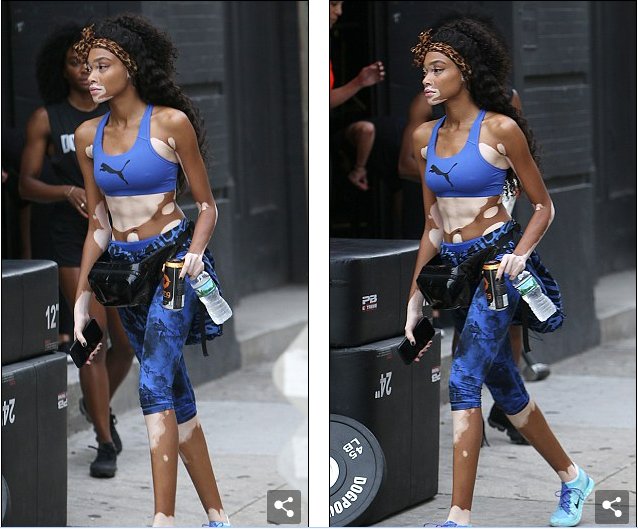 街拍白癜风超模WinnieHarlow，另一种的性感和自信