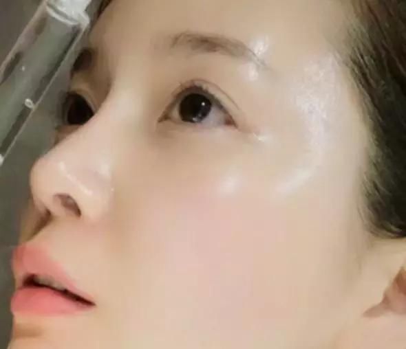 一碗水加点“醋”，就能轻松搞定祛斑，不再花钞票，就是这么任性