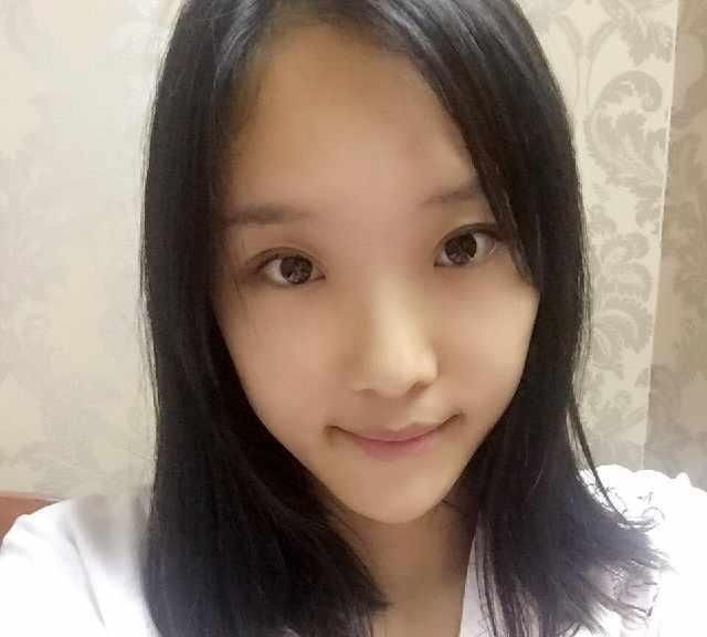  男友@小姐姐被男友带绿帽，分手后立马隆鼻，术后恢复让前任后悔莫及