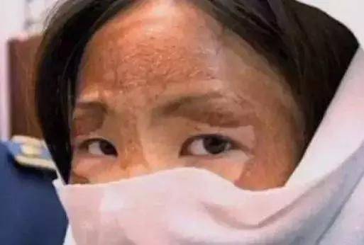 你以为你敷的是面膜，殊不知你敷的是“皮肤鸦片”!