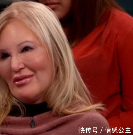 40岁的女人不顾反对，坚持整容，手术失败后丈夫的做法令人意外