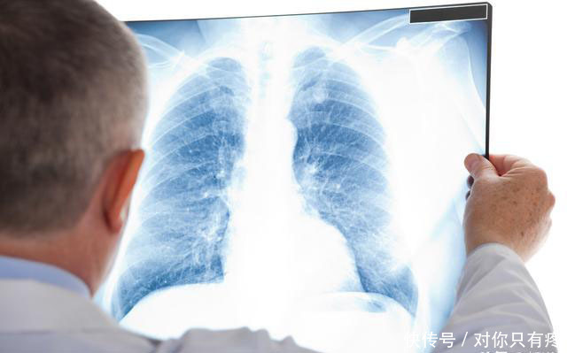 #检查#肺癌的诊断为什么要做那么多检查,哪一个最重要,越痛苦越重要