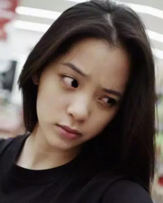 血管型黑眼圈@当妈后黑眼圈明显加重?黑眼圈不是病,挂在眼睛上真“要命”