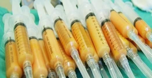 自体脂肪移植知多少?