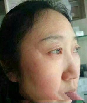 脸上长了“老年斑”不用着急，试试这个小方法，斑不见了脸还白了