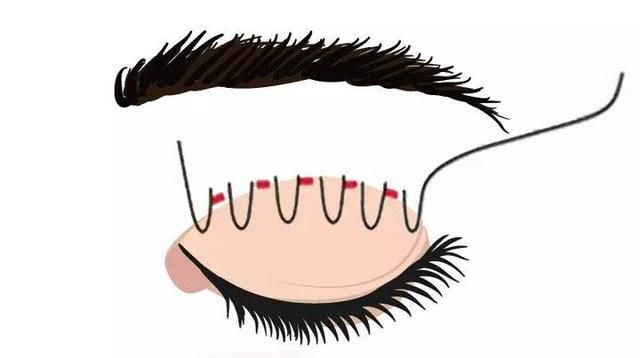  #小编建议#单眼皮与双眼皮的江湖，为什么双眼皮总能获得青睐？