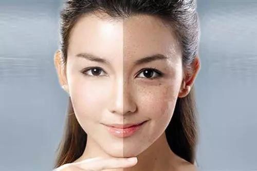 整容遭报应?她的少女脸这么快就烂了?