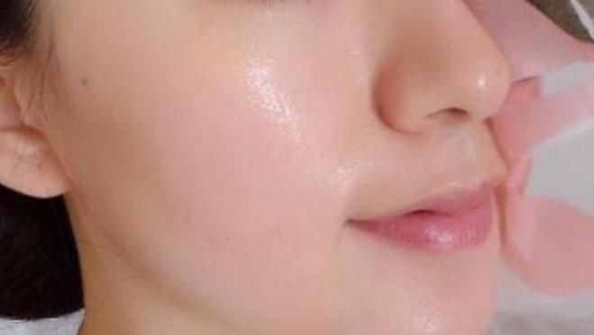 睡前擦一下维生素E，只需10分钟，斑点悄然离去，祛斑比激光还快