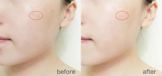 性价比逆天!大瓶好用的湿敷新宠，美白补水缩毛孔，0差评，上架就