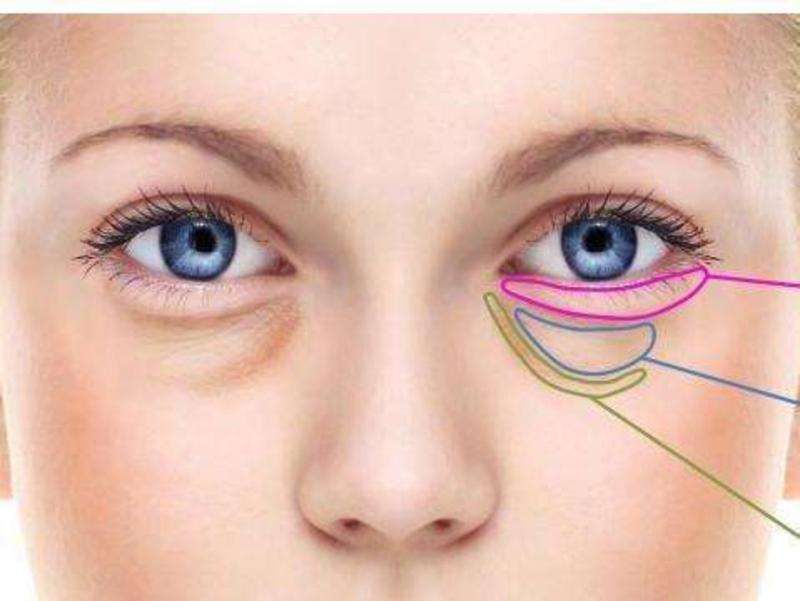 高龄皮肤主任告诉我:药店常见的药膏、用上3天，皱纹眼袋全消失