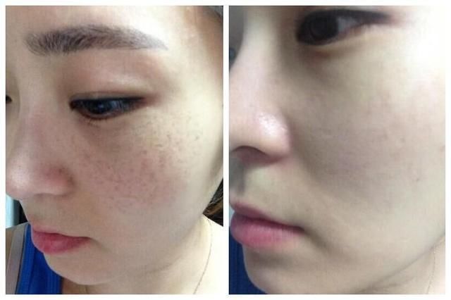 牙膏还可以这样用，只需每晚这样涂一涂，肤嫩如新生儿