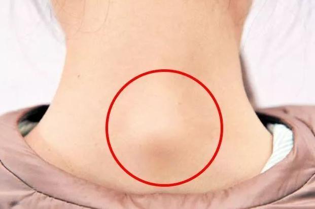 王菲和袁泉气质出众的秘诀：花几十万整容不如先解决这些？！