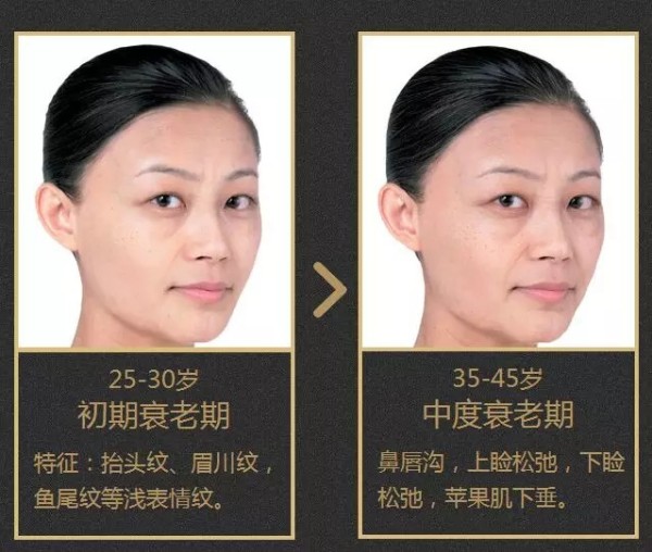 苏州紫馨逆龄术--让年龄成为秘密,悦升线苏州区首发